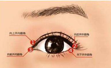 韩式开眼角手术的优点