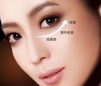北京丰台医院美容科眼袋脂肪释效果很明显吗