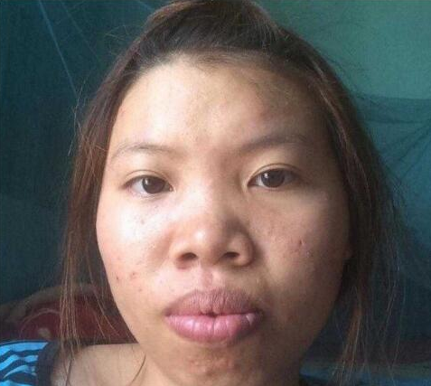 越南丑女艾米整容 术后嫁<font color=red>富二代</font>改变了她的一生