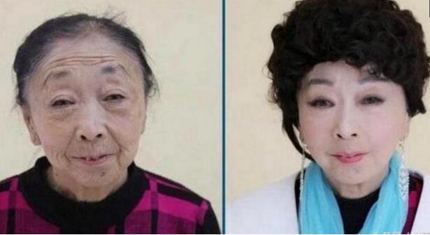 71岁老态为嫁小40男友 怡然决定去做整容手术