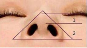 鼻子不好看可以做鼻部整形，那如何打造理想的鼻头
