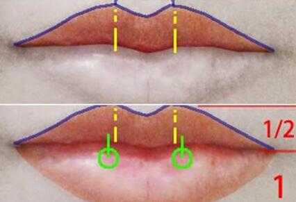 厚唇修薄的术前注意 塑造出诱人的嘴唇