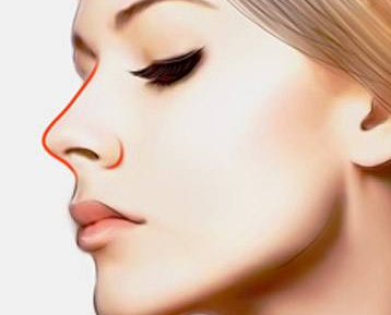 <font color=red>歪鼻矫正的步骤</font> 恢复鼻子完美的线条