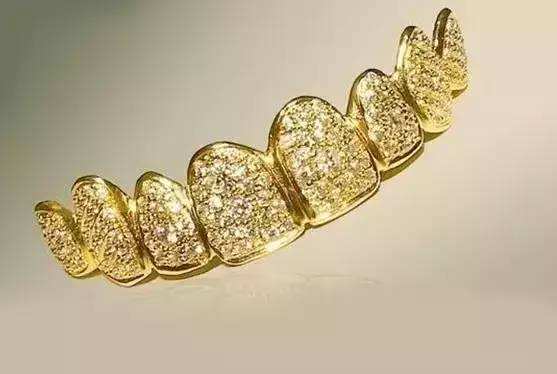 黄金烤瓷牙有什么特点呢 黄金烤瓷牙的危害有哪些呢