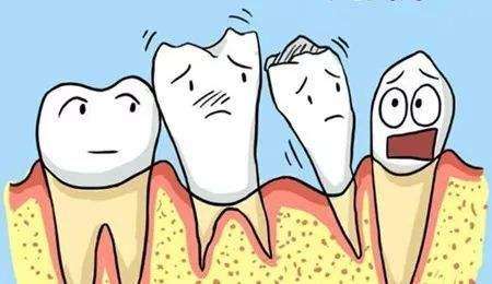 牙龈萎缩还可以进行<font color=red>种植牙手术</font>吗 种植牙的适应症有哪些呢