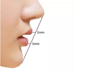 自体软骨隆鼻尖材料分类 自体软骨隆鼻尖价格是多少
