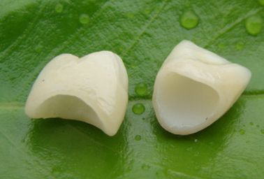 牙冠种植的过程怎么样呢 种植费用怎么样呢