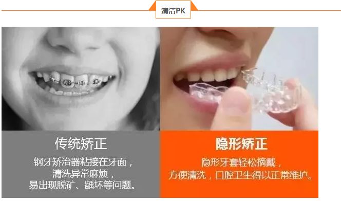 隐形牙齿矫正的原理怎么样呢 矫正的种类有哪些呢