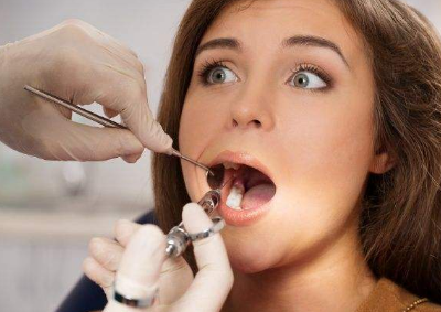 种植牙的优势 厦门思明峰煜口腔医院种植牙成功率多少