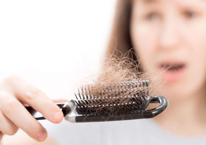 女性头发种植后会容易脱落吗 女性头发种植后如何护理