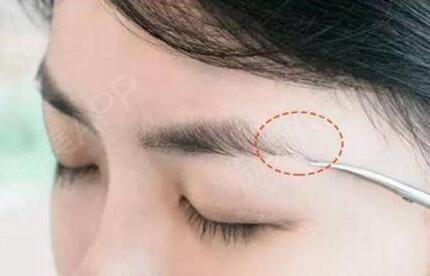 纹眉要多少钱  上海俞世放整形医院纹眉效果能够保持几年