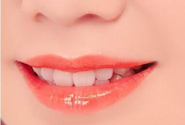 丹东新运韩式整形医院纹唇术的优点  甩掉你苍白色的嘴唇