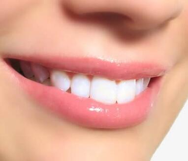上海华尔康口腔医院牙齿的种植价格 术后护理措施