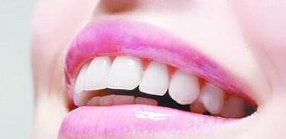 合肥美奥口腔整形医院种植牙可以用多少年 材料有哪些