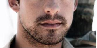 男性的魅力是什么 深圳科发源植发医院胡须种植