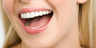 上海圣贝口腔整形医院种植牙的优点是什么 需要注意什么