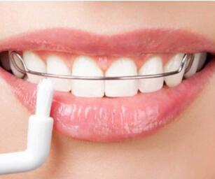 北京维乐口腔医院隐形牙齿矫正优点是什么