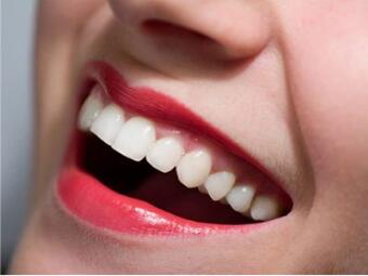 西安莲湖圣贝<font color=red>口腔整形</font>医院牙齿矫正多少钱 牙齿更加整齐