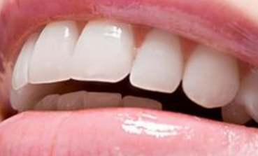 <font color=red>烤瓷</font>牙矫正牙齿的特点是什么 重庆齐美口腔门诊部怎么样