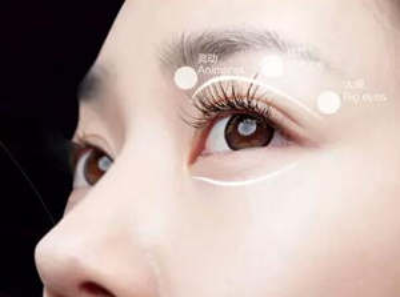广州粤美整形医院做吸脂手术去眼袋多少钱 对眼睛有害吗