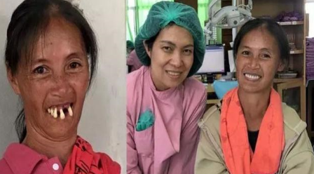 泰国残疾大妈免费整形装假牙 找回了47年未有过的自信