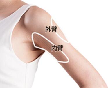 北京美莱整形医院<font color=red>手臂吸脂的优势有哪些</font> 塑造优美曲线