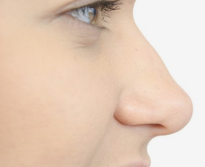 广西医科大学整形医院鼻尖整形的四种方式 要多少钱
