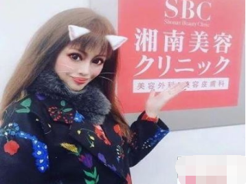 日本椿朋海因被母亲说丑 竟全身上下动了300次手术