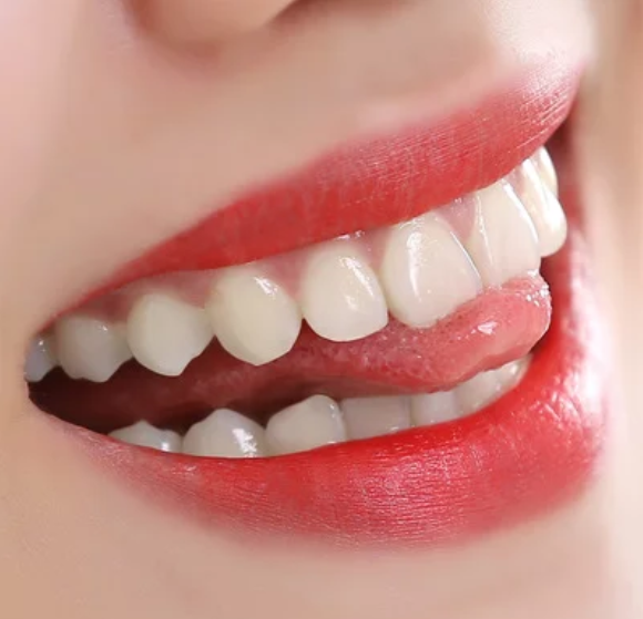 牙齿矫正的方法有哪些 广州<font color=red>牙齿矫正贵吗</font>