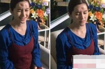 泰国女子Nong Guang做额头填充失败 额头竟流出黄色膏状物
