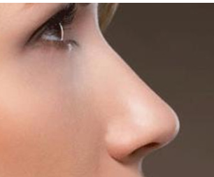 惠州元辰整形医院鼻尖整形手术优势 改善你的美中不足