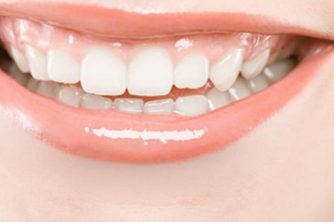 重庆铂生门诊部口腔科种植牙效果如何 可以维持多久