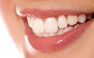 听说牙齿矫正很贵 上海东奥口腔门诊部牙齿矫正优点