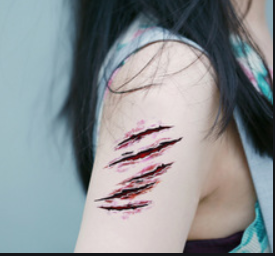 西安华仁医院整形科激光祛疤会不会损伤皮肤呢 价格是多少