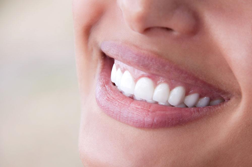 美白牙齿方法哪种好 武汉达美口腔美白牙齿后注意哪些