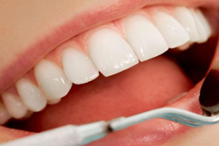 北京齿康口腔门诊部种植牙使用寿命 种植牙后注意事项