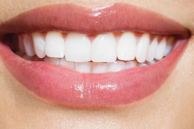 牙齿矫正需要做哪些检查 北京维嘉口腔医院牙齿矫正方法