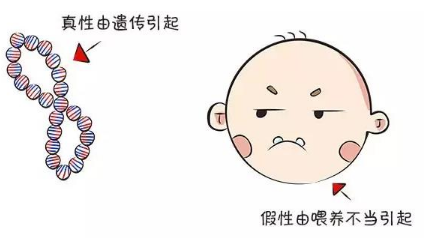 北京地包天矫正乳牙期可以做吗 让孩子早日摆脱异样的眼光