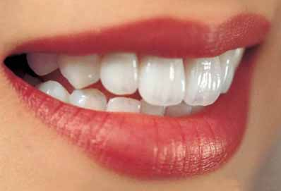 <font color=red>北京烤瓷牙</font>让您轻松拥有整齐洁白的牙齿 告别大黄牙