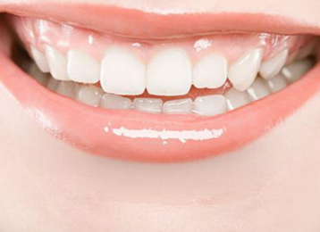 上海博厚口腔医院<font color=red>牙齿正畸</font>多少钱 牙齿矫正改变你的龅牙