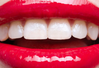 上海摩尔口腔医院全瓷牙的种类有哪些？<font color=red>烤瓷牙术后保护</font>
