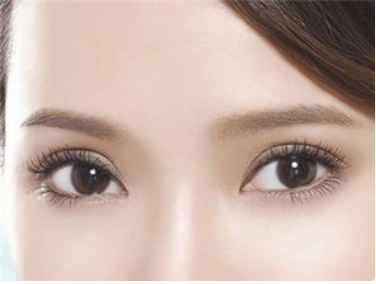 荆州第一人民医院整形科割双眼皮的效果 埋线伤口明显吗