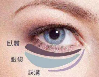 北京联合丽格刘越做去眼袋效果好吗 激光手术去眼袋的价格