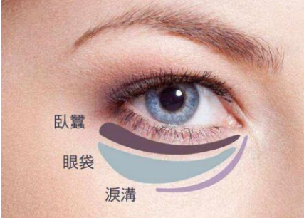 不手术可以祛眼袋吗 <font color=red>北京激光去眼袋</font>优势