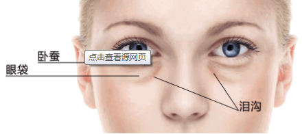 武汉<font color=red>手术祛眼袋</font>哪个医院好 去眼袋效果是永久的吗