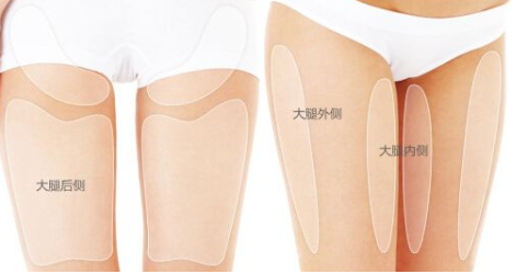 上海真爱医院整形科做大腿吸脂多少钱 瘦腿效果好吗