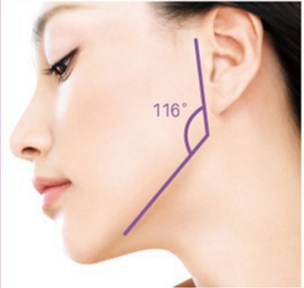 女人下颌角宽大怎样改善 北京艺美整形医院下颌角整形好吗