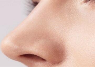 鼻尖整形有哪些分类 广州妍雅整形医院鼻尖整形效果好吗