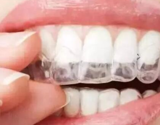 如何挑选牙齿矫正的材料 合肥世佳口腔医院专家来教你