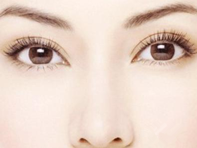 上海美莱整形医院杜园园做双眼皮修复原则 东方美眼巨匠